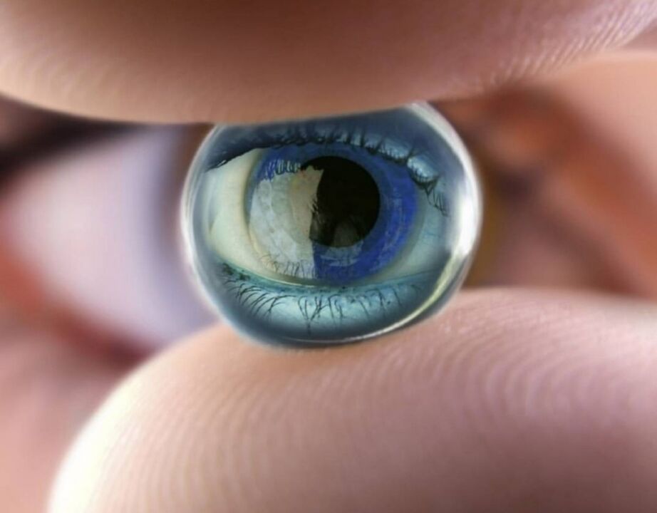 Naktiniai ortokeratologiniai lęšiai sustabdys regos sutrikimo progresą